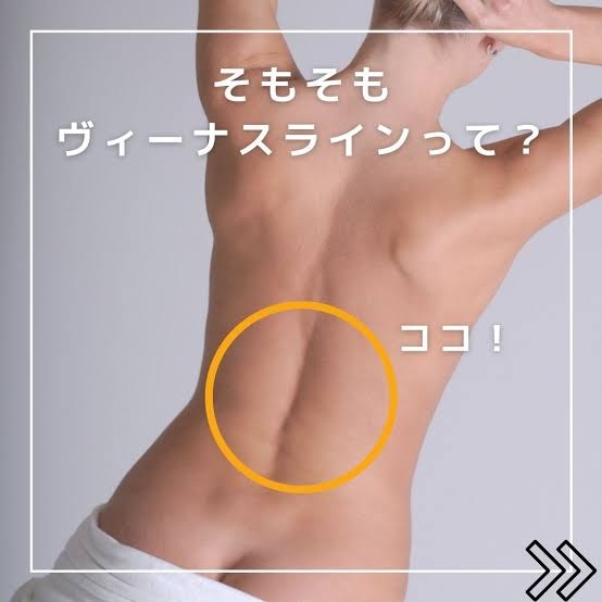 ヴィーナスラインある人