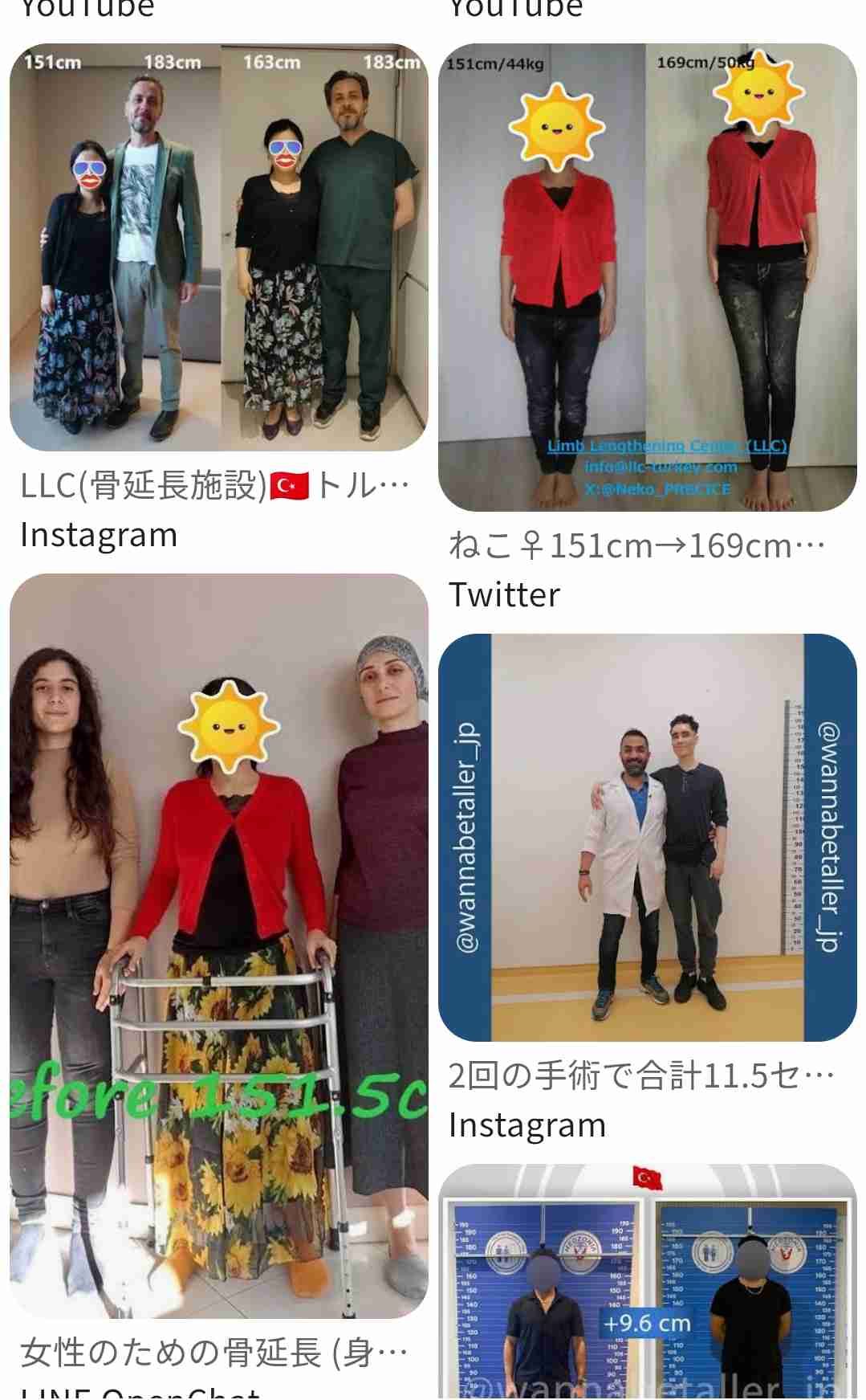 「見てるだけで痛い」整形総額3000万円…〝骨延長〟ショットに驚愕「整形界のボス」「そこまでする…?」元キャバ嬢まおちゃる