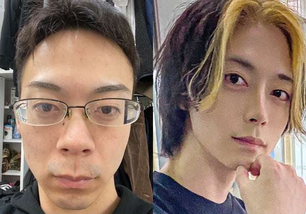 「見てるだけで痛い」整形総額3000万円…〝骨延長〟ショットに驚愕「整形界のボス」「そこまでする…?」元キャバ嬢まおちゃる