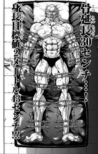 「見てるだけで痛い」整形総額3000万円…〝骨延長〟ショットに驚愕「整形界のボス」「そこまでする…?」元キャバ嬢まおちゃる