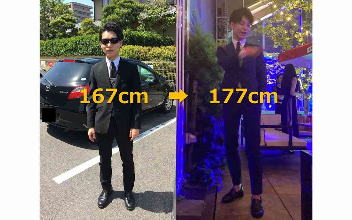 「見てるだけで痛い」整形総額3000万円…〝骨延長〟ショットに驚愕「整形界のボス」「そこまでする…?」元キャバ嬢まおちゃる