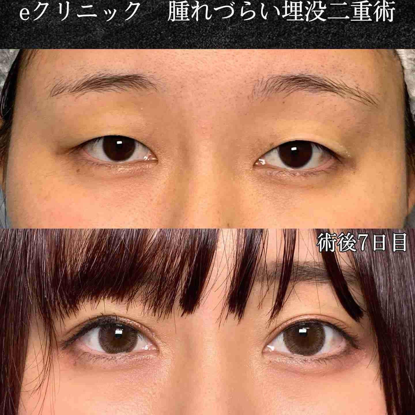 「顔が量産型だね」と言われたら、褒め言葉だと思いますか?失礼だと思いますか?