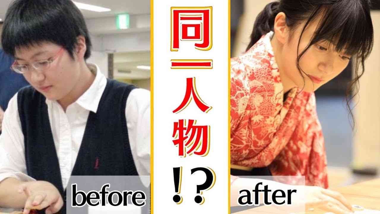 無整形なのに大人になって顔が変わった人。