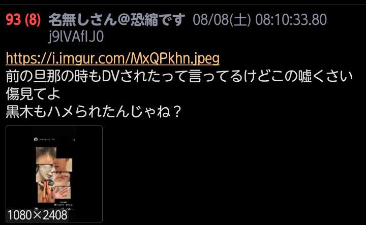 宮崎麗果　夫・黒木啓司さんからのDV被害を告白「断続的に首を絞められ…」一部報道に言及