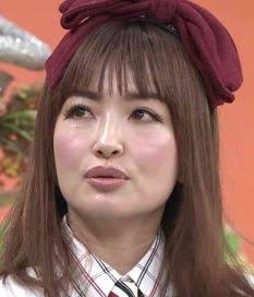 中町綾、「ブスになっても...」顔のヒアルロン酸“全溶かし”報告 「あざすごいよー」と術後顔面も公開