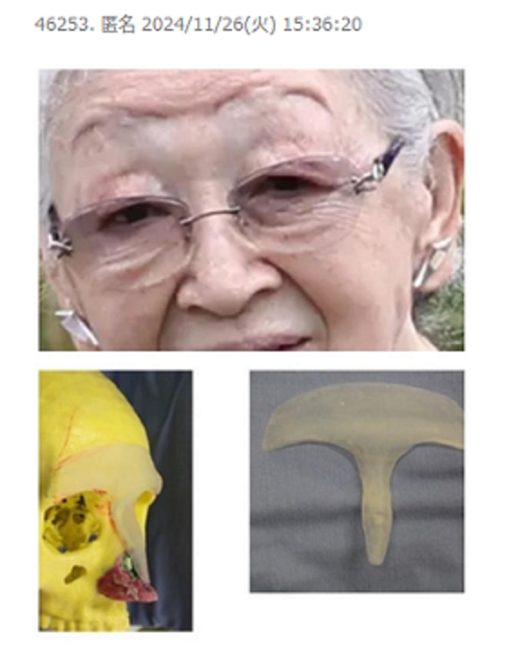 https://up.gc-img.net/post_img/2026/08/upN9jFK1BfVLLwJ_Dvd17_8732.png