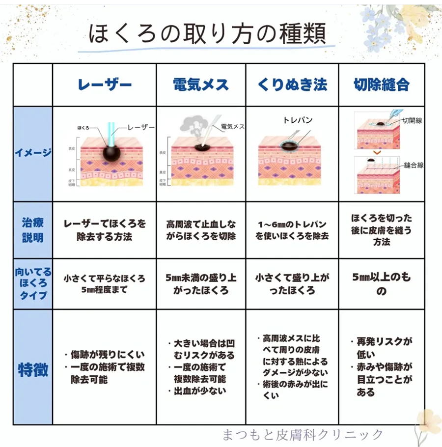 【情報交換】ほくろ除去【経験談】Part5