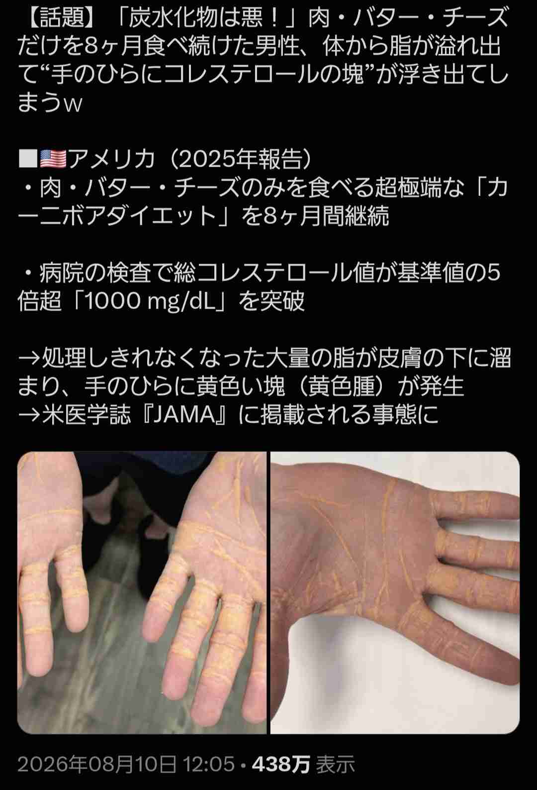 野菜って食べないとどうなるの？