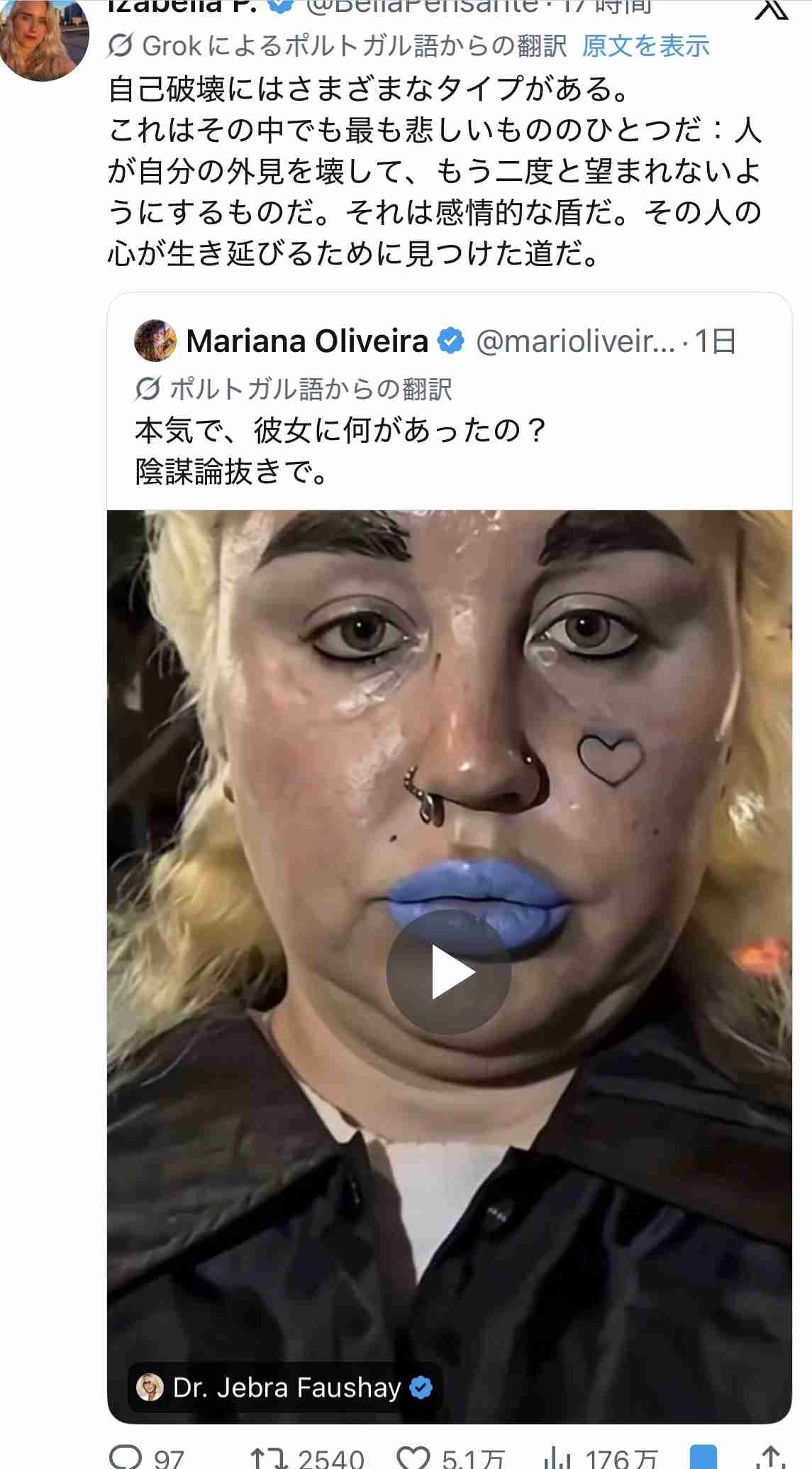 ハリウッドスターは何で精神的に不安定な人が多い?