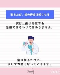 歯についての情報交換