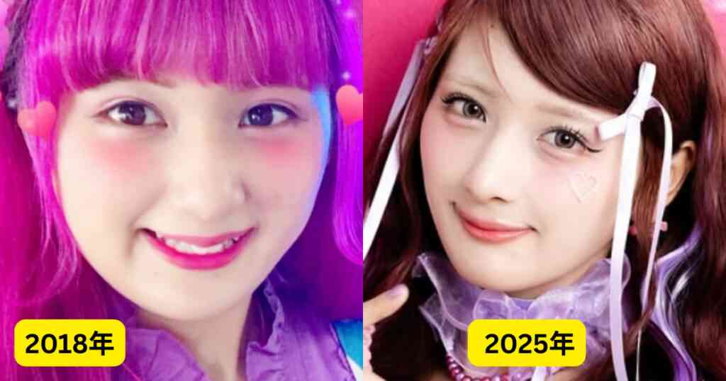 23kg減のしなこ、“激変”ぶりに「え!?」　ファンも仰天「わからない」「やっぱり可愛い」