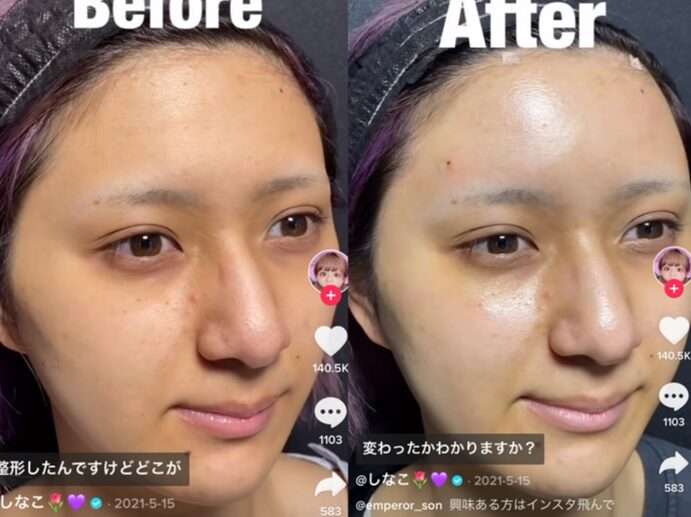 23kg減のしなこ、“激変”ぶりに「え!?」　ファンも仰天「わからない」「やっぱり可愛い」