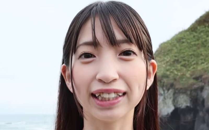 歯列矯正したいけどしてない人