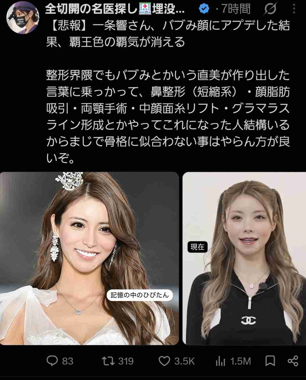 「記憶の中のあゆと違う…」浜崎あゆみ(47歳)日テレ『歌の感謝祭』で久々の地上波歌唱! 最新近影に「毎回ビジュ変するのがあゆ」驚きと賞賛の声