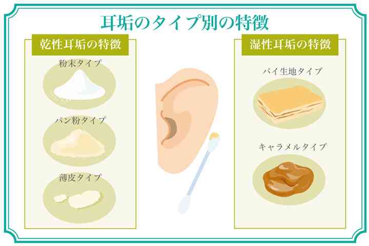 耳垢ベトベトタイプな人
