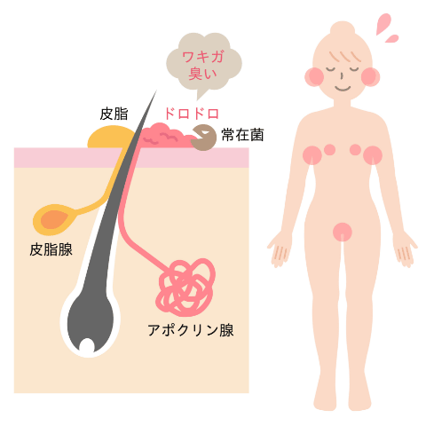 耳垢ベトベトタイプな人