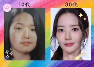 【美容整形】外見を変えることは幸せに繋がるのか?