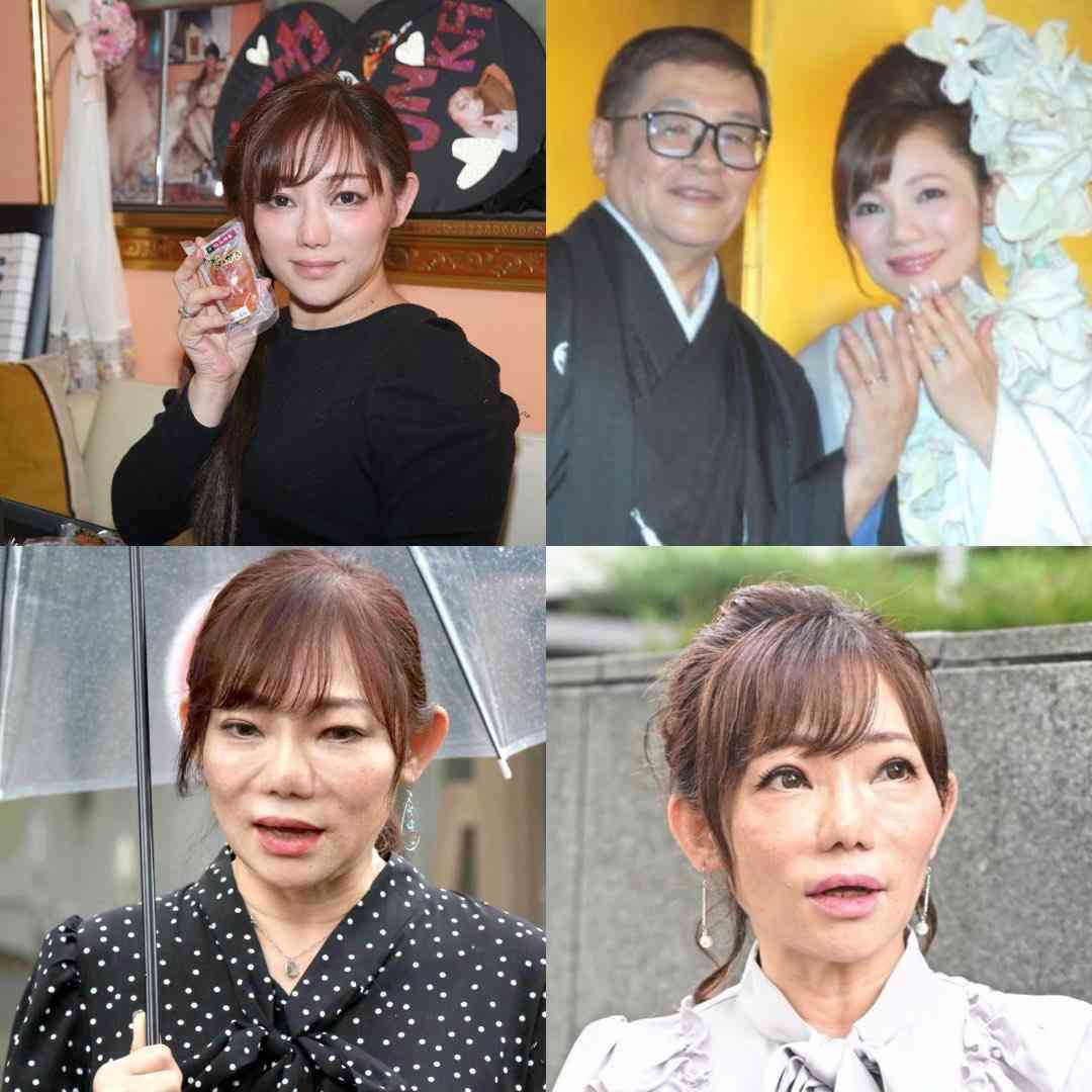 【美容整形】外見を変えることは幸せに繋がるのか?