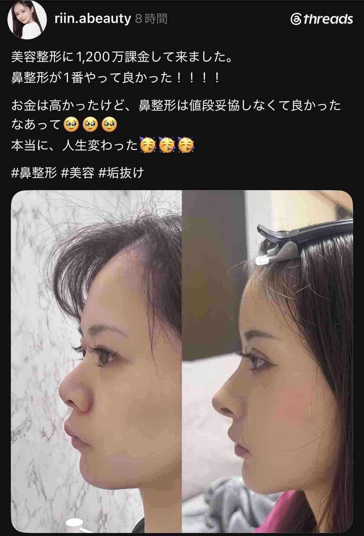 【美容整形】外見を変えることは幸せに繋がるのか?
