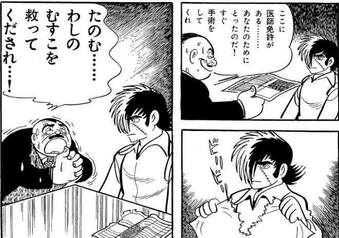 【手塚治虫】ブラック・ジャック(間黒男)について知っていること【闇医者】