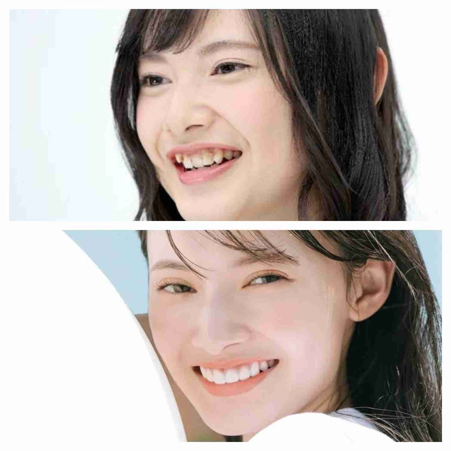 歯並びが悪いと育ちが悪そうって思う?