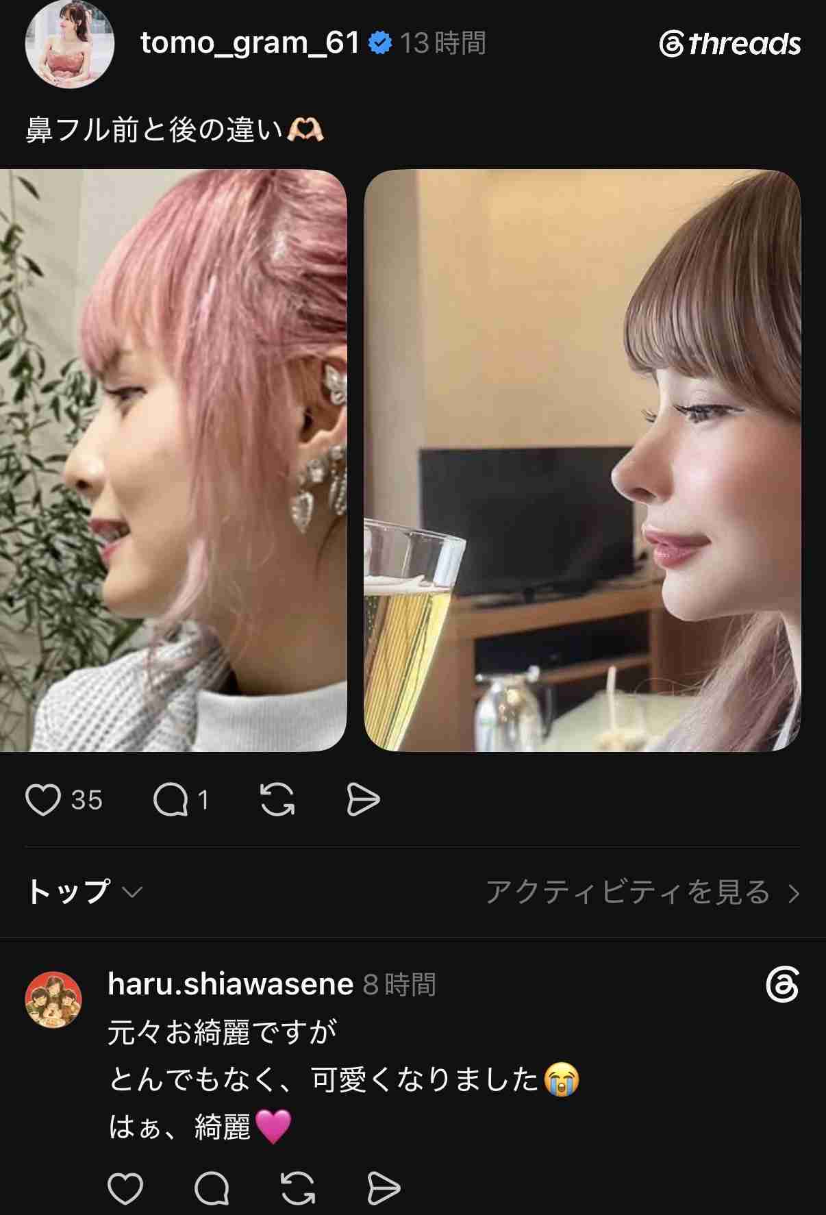 「整形総額1000万円超」元トップアイドルが本人役で『ダウンタイム』出演　兒玉遥に「気付かなかった」「やっぱり」の声
