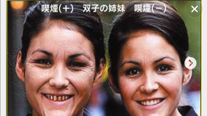 老化が現れる体の箇所