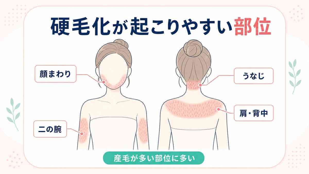 顔脱毛の経験談が聞きたい