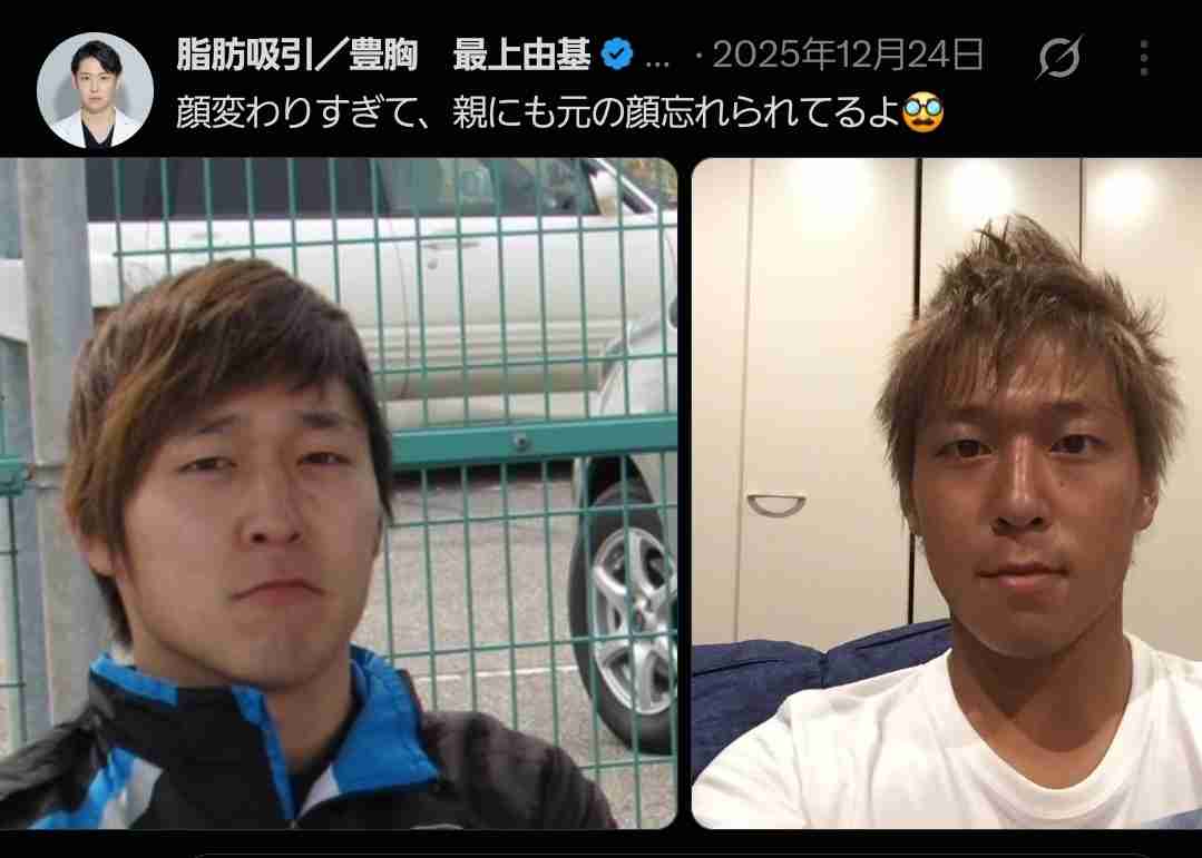 未成年女性に性的暴行加えた疑い 美容クリニックの医師を逮捕 テキーラやハブ酒を飲ませて意識もうろうとさせ…