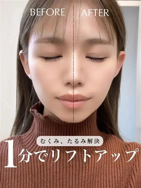 40歳以降のリフトアップ施術