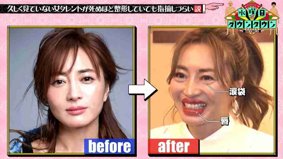 三吉彩花、「顔面麻痺」から復帰直後の韓国 “ぽってり” メイクをキャッチ「カバーするためかな」ファンも不安