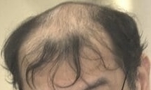 顔の一部分だけで有名人を当てるトピ part2