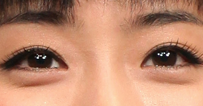 顔の一部分だけで有名人を当てるトピ part2