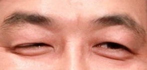 顔の一部分だけで有名人を当てるトピ part2