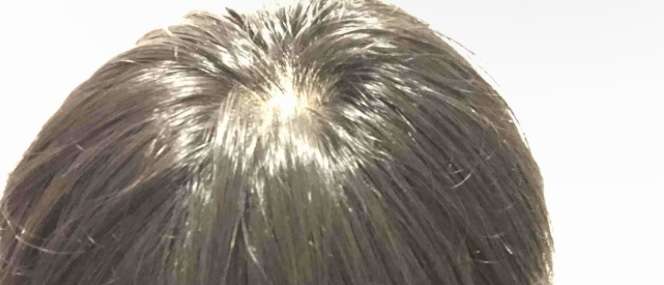 40代半ばで、グレイヘアは早いでしょうか?