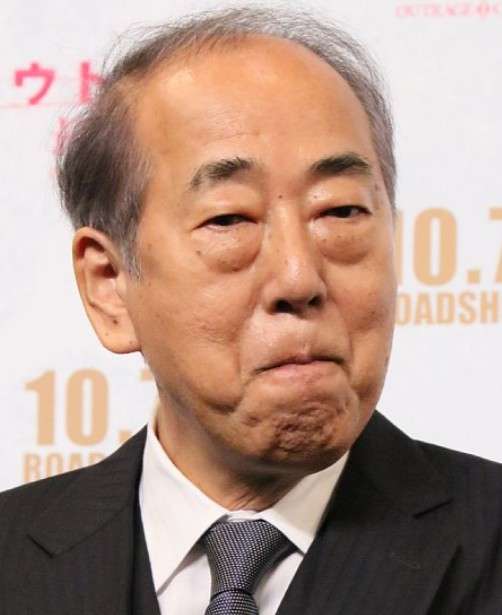 目袋が急に目立ってきた