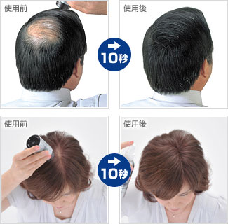 ズラの有名人ってだれ？