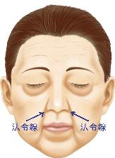 ほうれい線対策