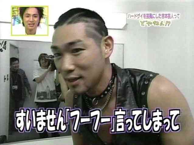 モデルに転向したレイザーラモンHGが目を整形したと話題に