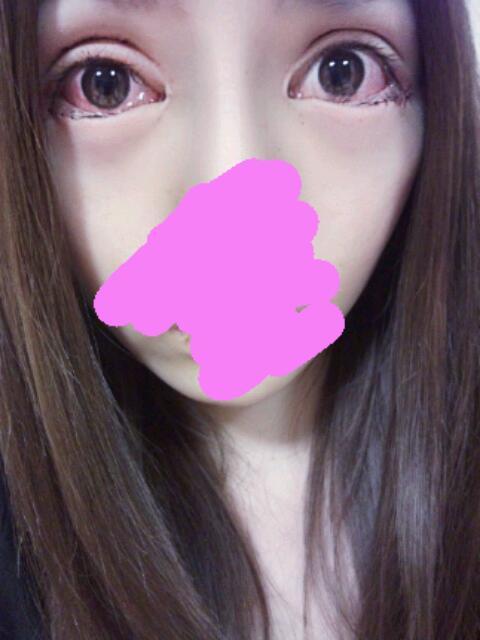 両目｜美容整形と摂食障害と私