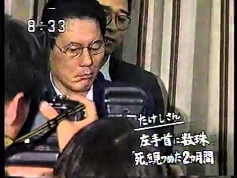 北野武　バイク事故で顔がガチャピンにｗｗｗｗｗｗｗｗｗｗｗｗ - YouTube