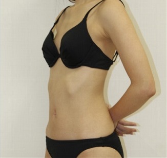 ビーチで見かける「ちょっと痛い」女性の特徴ランキング