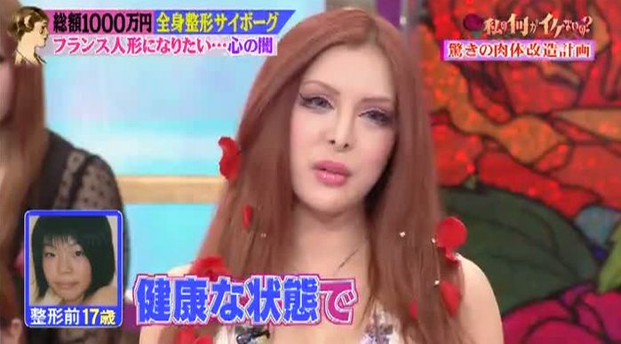 整形サイボーグ・ヴァニラ、4月にカスタムして、Jカップに