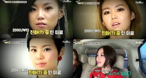 K-POPアイドルが整形を告白！「アルバム発表の度に進化してます」