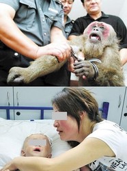 観光地のサルが男の子の睾丸をむしり取り、食べる―中国貴州省(毎日中国経済) - 海外 - livedoor ニュース