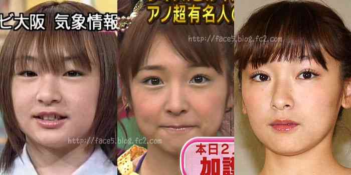 加護亜依の顔がまた変わってると話題に…