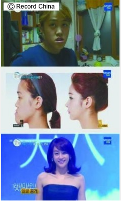 行き過ぎた韓国の美容整形ブーム…「こんなに美しくなった！」とあおるテレビ番組のせい