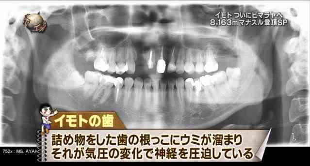 イモトアヤコ、8163mのマナスル登頂に成功！