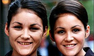 喫煙者・非喫煙者の双子を比べた結果…