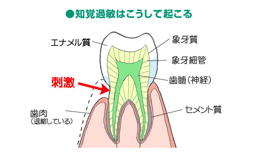 歯のトラブル